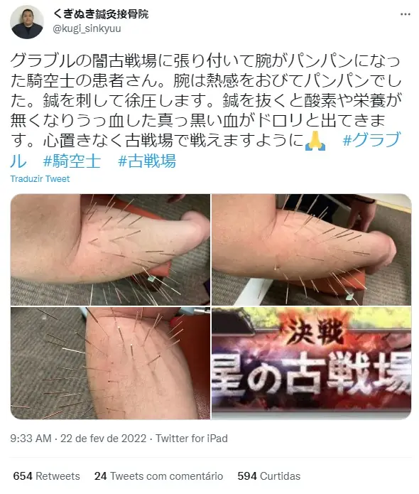 Otaku ends up in Acupuncture after playing too much Granblue Fantasy