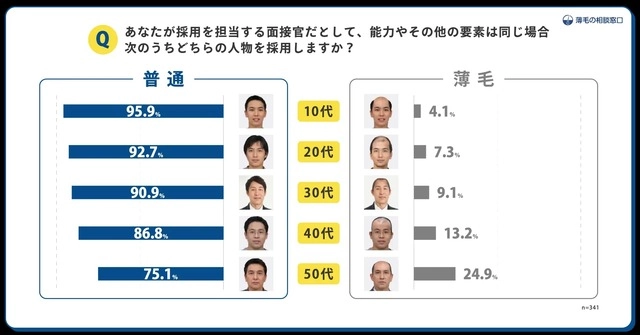 Bald men have more difficulty finding job in Japan?